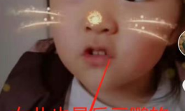 护士小姐姐模仿岳云鹏,岳云鹏经典台词再现江湖